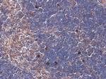 ARHGEF18 Antibody in Immunohistochemistry (Paraffin) (IHC (P))