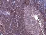 ARHGEF18 Antibody in Immunohistochemistry (Paraffin) (IHC (P))