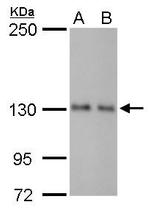 ARHGEF18 Antibody in Western Blot (WB)