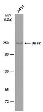 Dicer Antibody in Western Blot (WB)