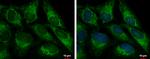 FIS1 Antibody in Immunocytochemistry (ICC/IF)