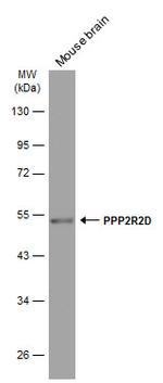 PPP2R2D Antibody in Western Blot (WB)