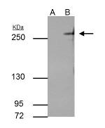 TET2 Antibody in Immunoprecipitation (IP)