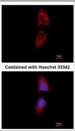 PNPase Antibody in Immunocytochemistry (ICC/IF)