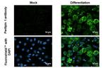 Perilipin 1 Antibody in Immunocytochemistry (ICC/IF)