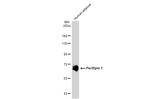 Perilipin 1 Antibody in Western Blot (WB)