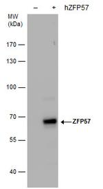 ZFP57 Antibody in Western Blot (WB)