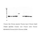 Emerin Antibody in Western Blot (WB)