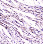 FABP3 Antibody in Immunohistochemistry (Paraffin) (IHC (P))