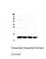 FABP3 Antibody in Western Blot (WB)