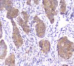 SMN1/SMN2 Antibody in Immunohistochemistry (Paraffin) (IHC (P))