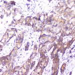 SMN1/SMN2 Antibody in Immunohistochemistry (Paraffin) (IHC (P))