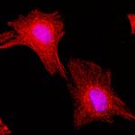 alpha Tubulin Antibody in Immunocytochemistry (ICC/IF)