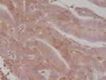 B7-H3 (CD276) Antibody in Immunohistochemistry (Paraffin) (IHC (P))