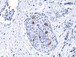 Cyclin B1 Antibody in Immunohistochemistry (Paraffin) (IHC (P))