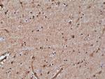 GSTP1 Antibody in Immunohistochemistry (Paraffin) (IHC (P))