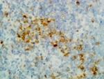 Human IgG (Heavy chain) Secondary Antibody in Immunohistochemistry (IHC)