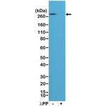 Phospho-Acetyl-CoA Carboxylase (Ser79) Antibody in Western Blot (WB)