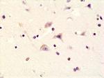 Phospho-GluR1 (Ser845) Antibody in Immunohistochemistry (Paraffin) (IHC (P))