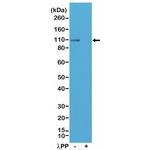 Phospho-GluR1 (Ser845) Antibody in Western Blot (WB)