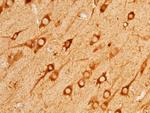 Angiotensinogen Antibody in Immunohistochemistry (Paraffin) (IHC (P))