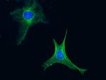 Adenylate Kinase 4 Antibody in Immunocytochemistry (ICC/IF)