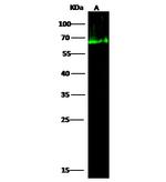 Human Serum Albumin Antibody in Western Blot (WB)