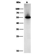 ALDH1A1 Antibody in Western Blot (WB)