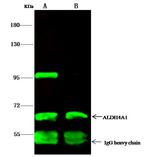 ALDH4A1 Antibody in Immunoprecipitation (IP)