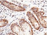 CD147 Antibody in Immunohistochemistry (Paraffin) (IHC (P))