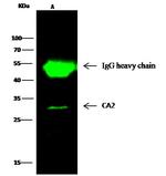 Carbonic Anhydrase II Antibody in Immunoprecipitation (IP)