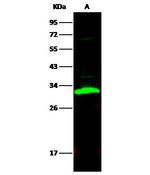 Carbonic Anhydrase II Antibody in Western Blot (WB)