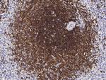 CD22 Antibody in Immunohistochemistry (Paraffin) (IHC (P))