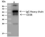 CD38 Antibody in Immunoprecipitation (IP)