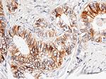 CDH17 Antibody in Immunohistochemistry (Paraffin) (IHC (P))