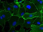 VE-cadherin Antibody in Immunocytochemistry (ICC/IF)