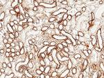 Tetranectin Antibody in Immunohistochemistry (Paraffin) (IHC (P))