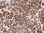 CLPS Antibody in Immunohistochemistry (Paraffin) (IHC (P))