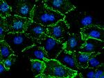 beta Catenin Antibody in Immunocytochemistry (ICC/IF)