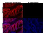 beta Catenin Antibody in Immunohistochemistry (Paraffin) (IHC (P))