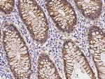 beta Catenin Antibody in Immunohistochemistry (Paraffin) (IHC (P))