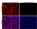 beta Catenin Antibody in Immunohistochemistry (Paraffin) (IHC (P))