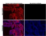 beta Catenin Antibody in Immunohistochemistry (Paraffin) (IHC (P))