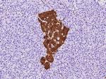 NSE Antibody in Immunohistochemistry (Paraffin) (IHC (P))