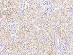 ENTPD5 Antibody in Immunohistochemistry (Paraffin) (IHC (P))