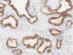 ENTPD5 Antibody in Immunohistochemistry (Paraffin) (IHC (P))