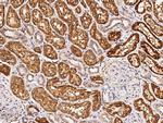 ENTPD5 Antibody in Immunohistochemistry (Paraffin) (IHC (P))