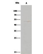 ENTPD5 Antibody in Immunoprecipitation (IP)