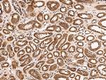 FGFR3 Antibody in Immunohistochemistry (Paraffin) (IHC (P))