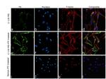 Fibronectin Antibody in Immunocytochemistry (ICC/IF)